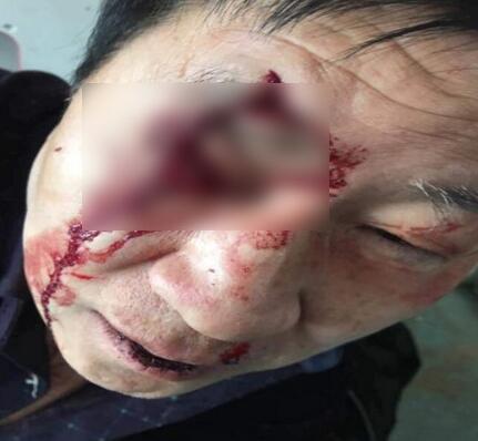 邯郸村支书儿子持斧行凶 好心老教师惨遭村霸毒打